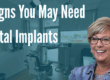 dental implants signs banner
