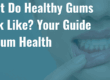 gum health