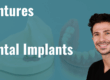 dentures vs dental implants