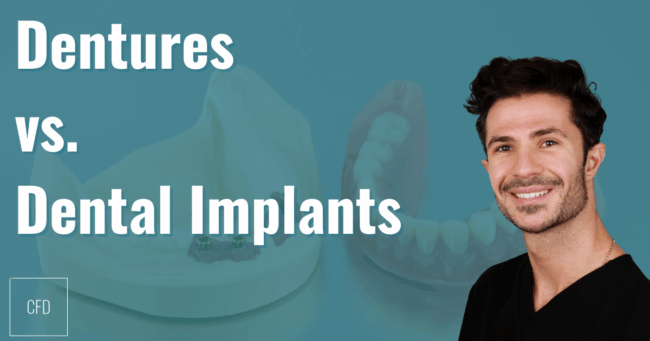 denturesvsimplantsland dentures vs dental implants