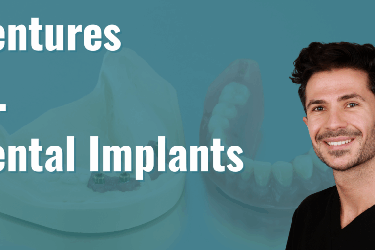 dentures vs dental implants