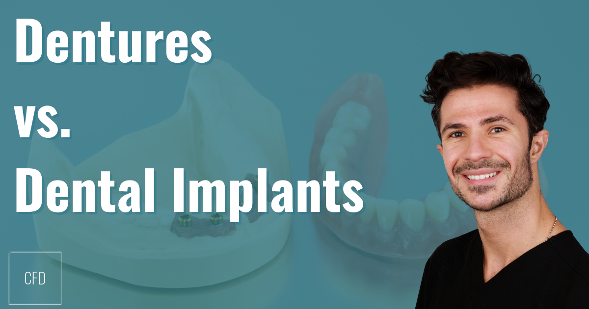 dentures vs dental implants