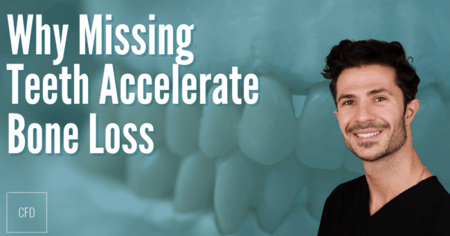 missingteethboneloss bonelossmissingteeth