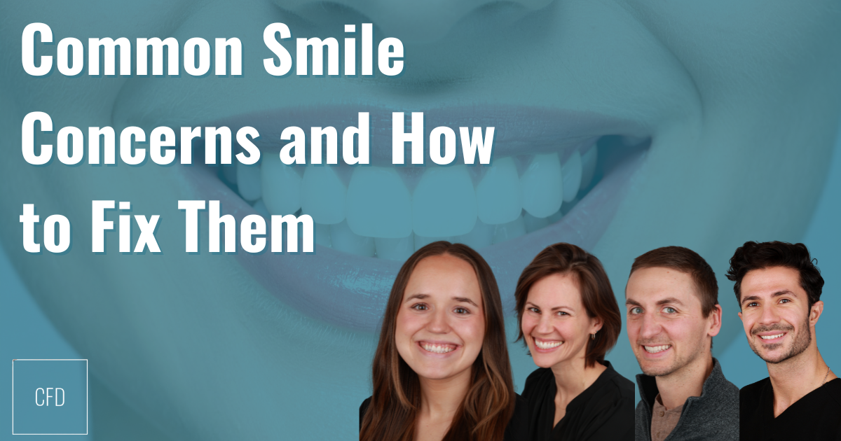 common smile concerns