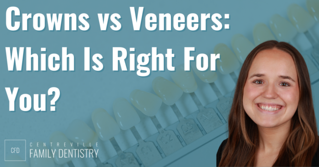 crowns vs veneers