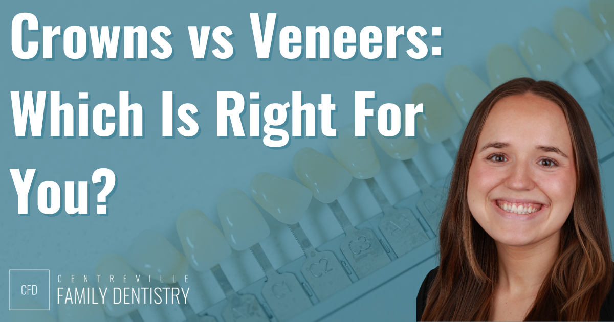 crowns vs veneers