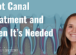 root canal