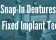 snap-in dentures vs all on 4 implant teeth
