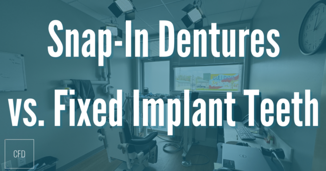 snap-in dentures vs all on 4 implant teeth
