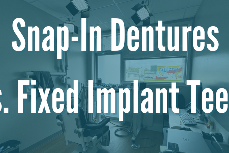 snap-in dentures vs all on 4 implant teeth
