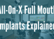 all-on-x full mouth implants