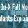 all-on-x full mouth implants