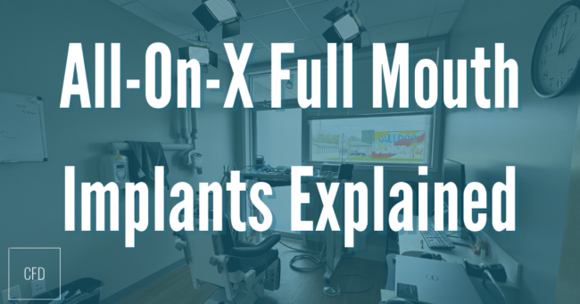 all-on-x full mouth implants
