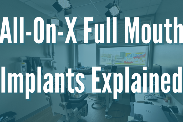 all-on-x full mouth implants