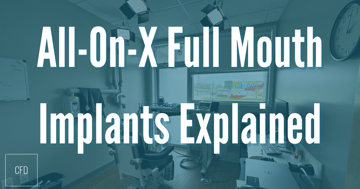 fullmouthimplants all-on-x full mouth implants