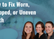 fix worn, chipped, or uneven teeth banner image