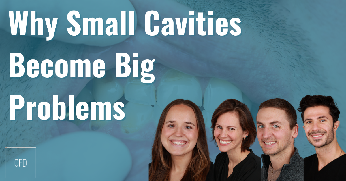 Why Small Cavities Become Big Problems