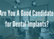 dental implant candidate photo