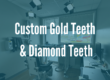 custom gold teeth banner