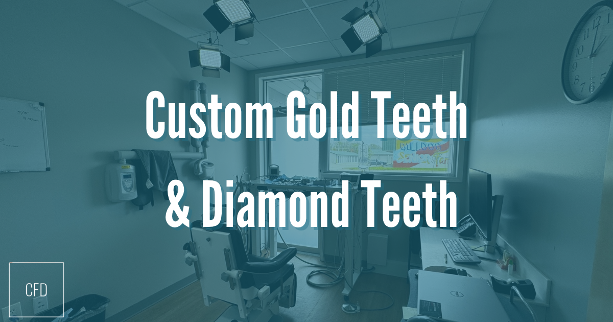 custom gold teeth banner
